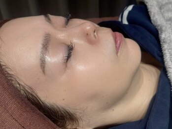 ビジュー(BIJOU)/プラピール+水玉リフティング