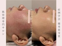 ファシネアオヤマ(FACINE AOYAMA)/症例学会　優秀賞受賞