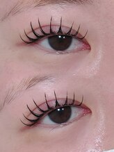 アテプラス(ate+)/アンドヘルシー80本