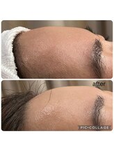 ラナン(ranan)/贅沢フェイシャル