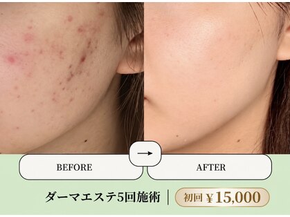 ベネミー 恵比寿(Benemi)の写真