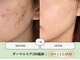 ベネミー 恵比寿(Benemi)の写真