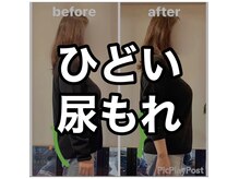 カワル整体 上通り院/尿もれで悩む人