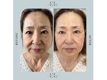ベルシック(Belchic)の雰囲気（お肌のお悩みはなんですか？シワ/たるみ/シミ/くすみ/毛穴/AGA）