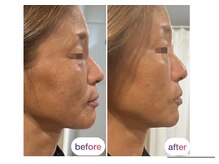 サロンド ビューティ ル マール(Le mar)の雰囲気（シワ・たるみ改善◎あなたの骨格・肌質に合わせてエイジングケア）