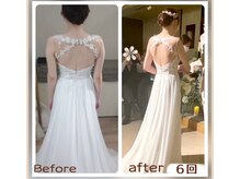 蒼(so)/原因から整える、持続小顔&華奢