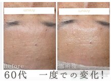 アルム(Areum)/乾燥・シワ・たるみも得意◎