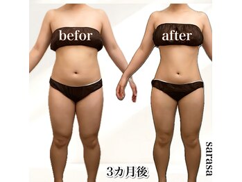 ナチュラル ビューティー スタイル さらさ(Natural Beauty Style)/ブライダル痩身でご来店