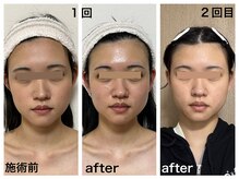 ダルセーニョ/２０２６年に向けてリセット開始