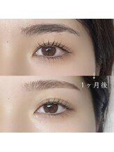 ミミー 表参道店(mimii)/まつぱ1ヶ月後ビフォーアフター