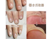 プティット シュシュ(Petit Chouchou)の雰囲気(自爪育成コース、foot巻爪ペディバランス取扱。トラブル爪も解消)