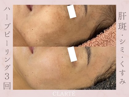 クラルテ(CLARTE)の写真