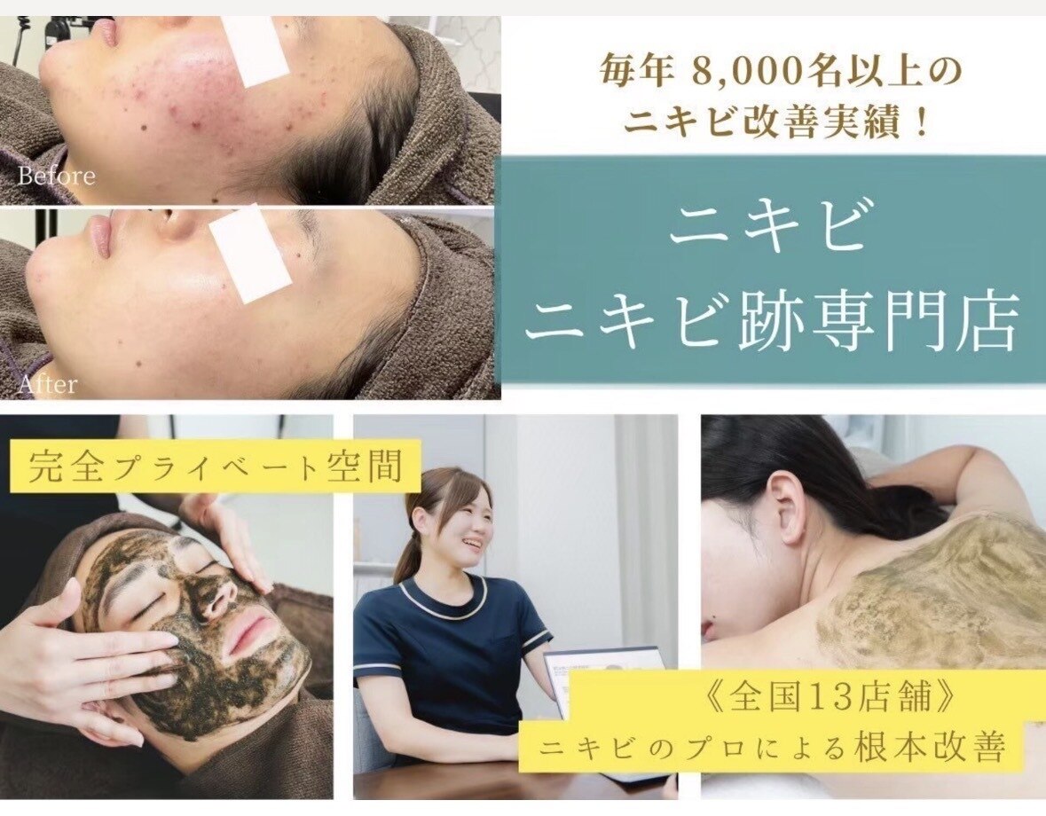 リボーンセレクト お家で本格エステケアセット ニキビ、ニキビ痕 