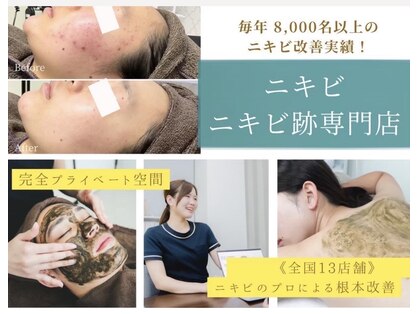 ニキビケア研究所 北千住店の写真