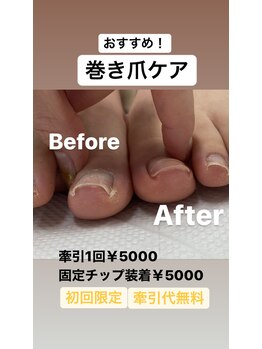 巻いたお爪のケアスタート☆