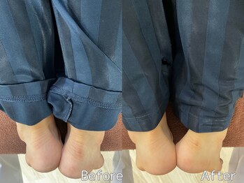 チアーライフ整体/整体/骨盤矯正の効果/マッサージ