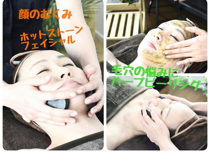 エムブルーム(m-bloom)の写真