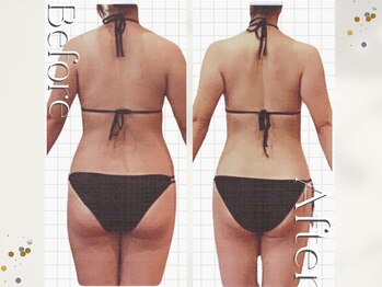 オームの森 北浜/特許取得のスペシャル痩身