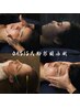 【頬骨・エラ張り/左右差/面長】OASIS式輪郭縮小術(小顔/小顔矯正/美容鍼)
