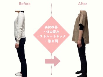 ひがし出来町接骨院/骨盤矯正/整体/小顔