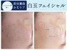 《美白ケア・シミケア/夏のお疲れ肌に》白玉フェイシャル 初回5,500円
