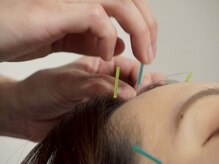 ビゴー鍼灸院 円山院(bigo鍼灸院)