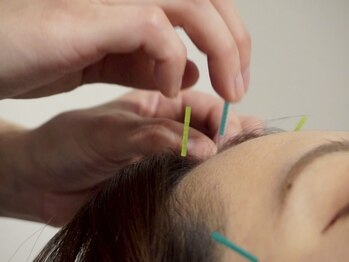 ビゴー鍼灸院 円山院(bigo鍼灸院)