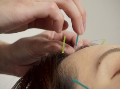 ビゴー鍼灸院 円山院(bigo鍼灸院)の写真