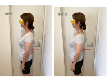 イーリス(i-ris)/美容整体×骨盤調整×リンパ