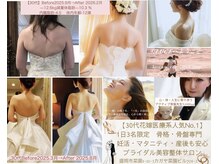 ビルーチェ(美LUCE)