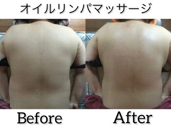 温和活 ロータス(温和活Lotus蓮:)/オイルリンパマッサージ施術変化