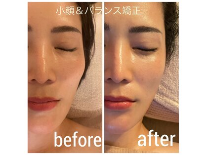 ディグニータココ 自由が丘(DIGNITA coco)の写真