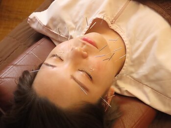 健康堂 道玄坂院/美容鍼コースも!