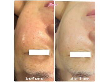 フルール(Fleur)/◆鏡を見るのが楽しくなる◆