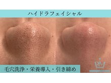 リメイククリニカルビューティー(Remake clinical beauty)/すっきり