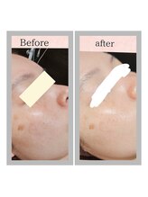 エターナル(Eternal)/ララピールでリセット