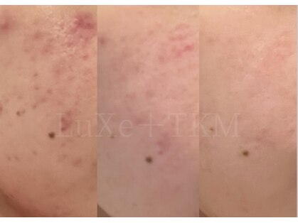 リュクス  Luxe＋tkm 南船場の写真