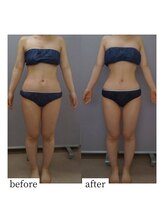アップルミント/＜痩身＞before・after