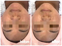 シルク(Cilk)/リフトアップEMSマッサージ付き