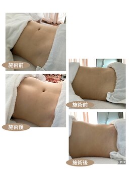 アノン 宮崎(anon)/骨盤調整+腸もみで見た目も◎