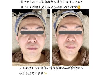 マリア(MALIA)/＃レモンボトル＃南森町エステ