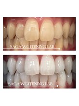 佐賀ホワイトニングラボ/