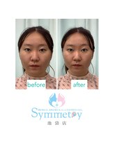 シンメトリー 池袋店/