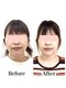 木の葉の写真/「なんか顔スッキリした？」周囲に言われる自然なバランス小顔へ！鏡を見るのが楽しみに！