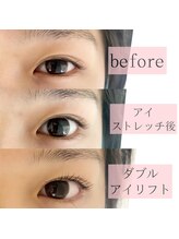 アイビューティー(AI beauty)/ダブルアイリフト
