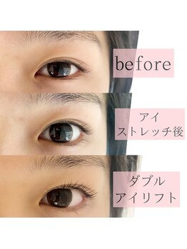 アイビューティー(AI beauty)/ダブルアイリフト