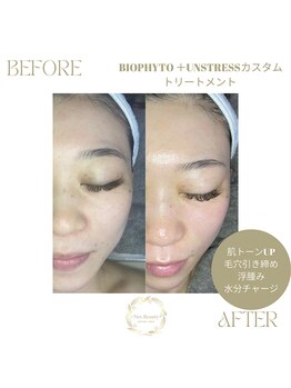 ネス 沖縄店(Nes.)/BIOPHYTO/UNSTRESSカスタム