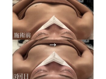 ブレスト サロン 奈良店(Bryst Salon)/バストアップ症例