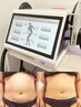 【初回体験/夏に向けて】薄手の服を着こなす!速攻脂肪燃焼◇贅肉撃退￥1,500
