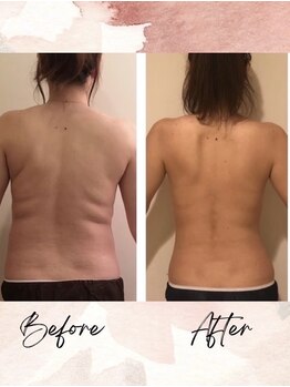 ヨサパーク アクアマリン 日野店(YOSA PARK)/ルルオン痩身♪